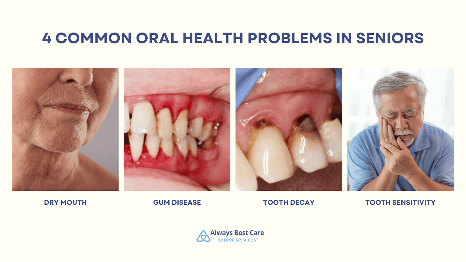 This is an infographic depicting the 4 common oral health problems in seniors