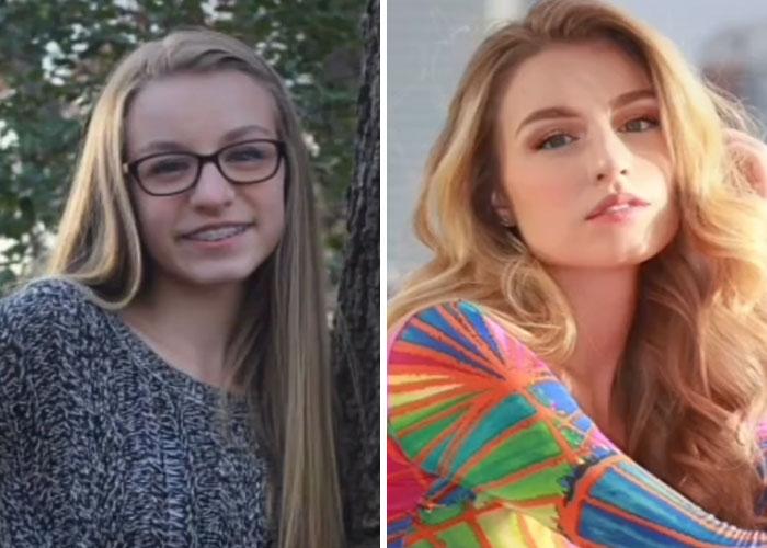 How Hard Did Puberty Hit You”: 30 People Who Took Part In This New TikTok  Challenge And Shared Photos | Bored Panda