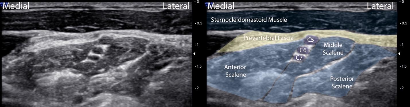 A close-up of a medical image

Description automatically generated