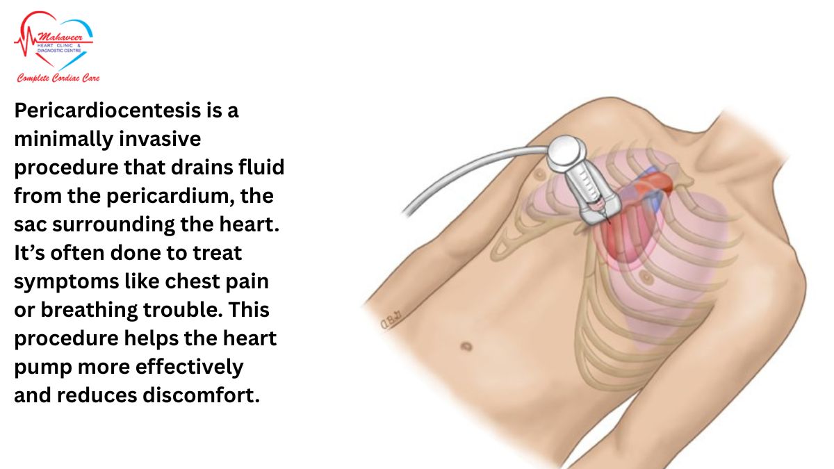 Pericardiocentesis - Dr Rakesh Jain , Best cardiologist