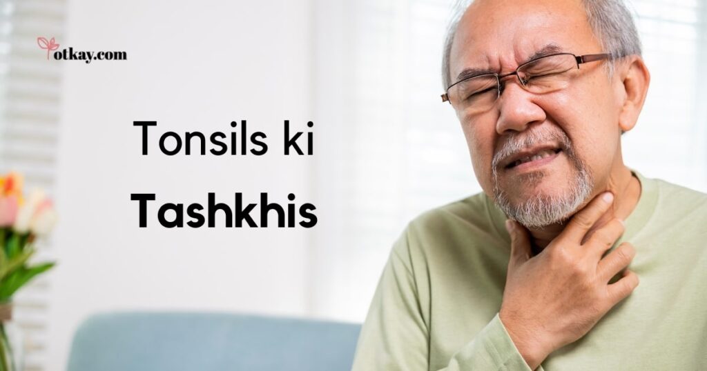 Tonsils ki Tashkhis
