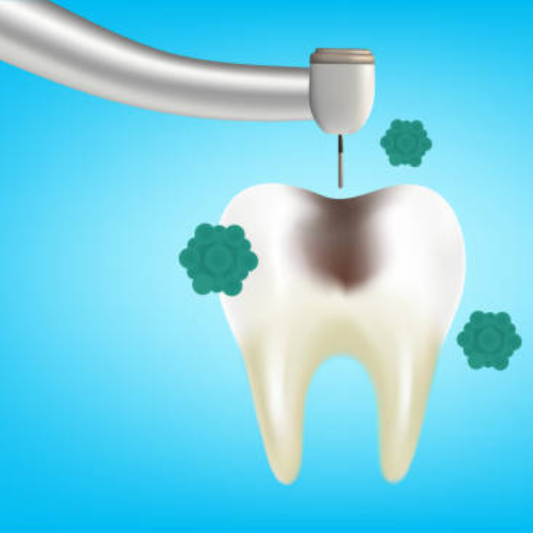 Define Cavity: A Comprehensive Guide for Boston Residents