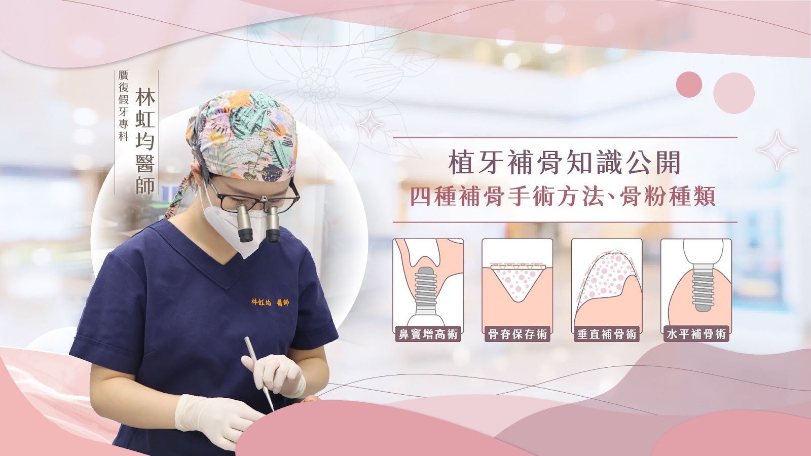 植牙補骨手術全解析：四大方法與適用對象