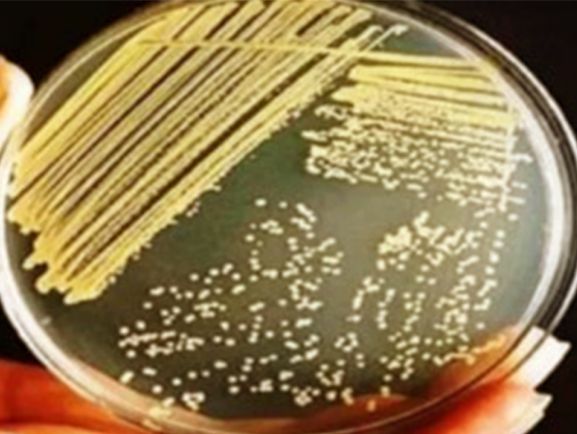 Nutrient Agar