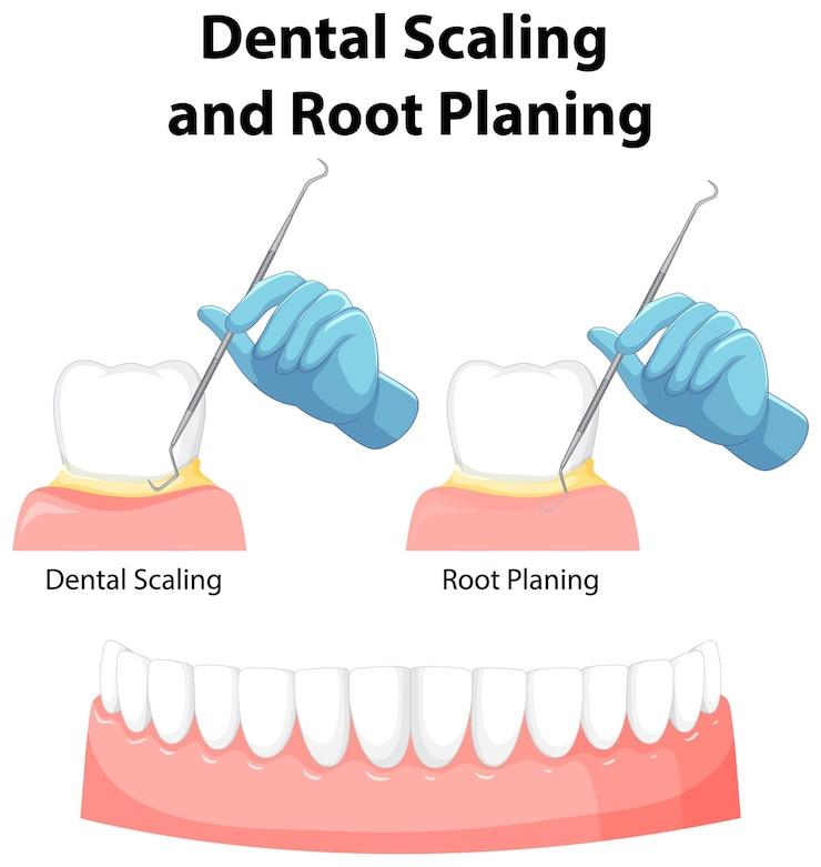 dentist vs periodontist