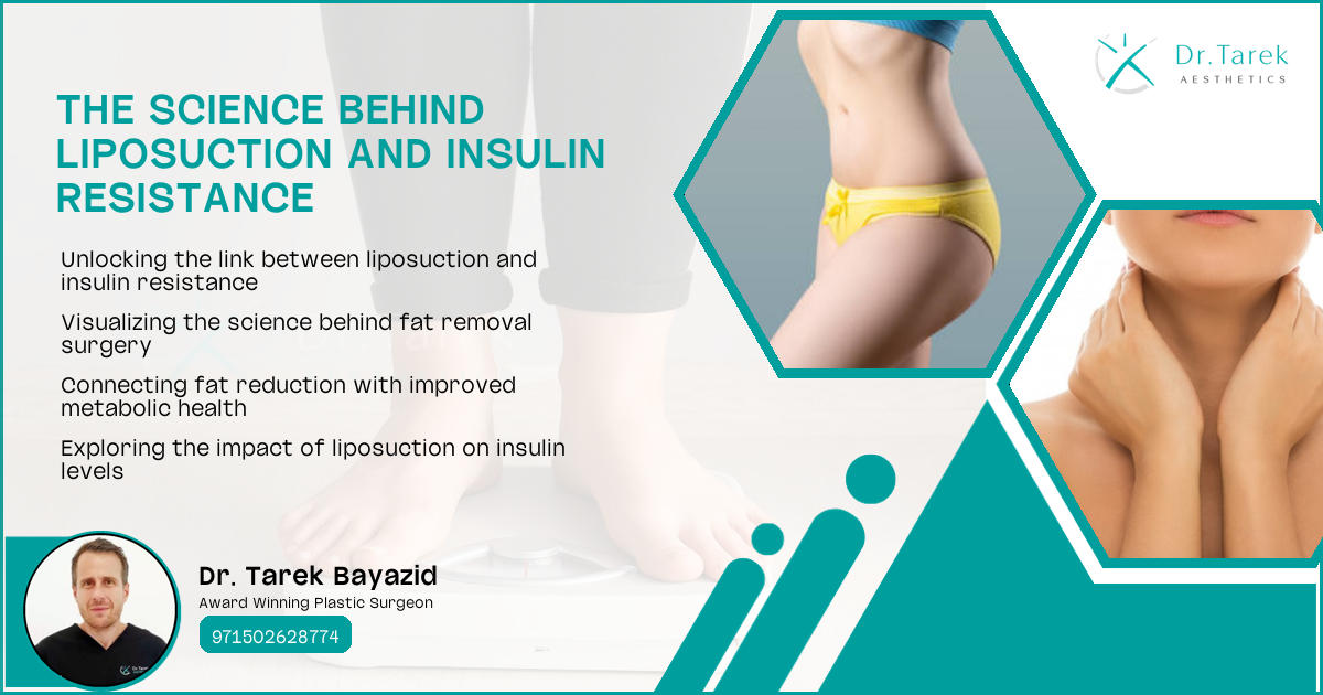 Can Liposuction Help Insulin Resistance