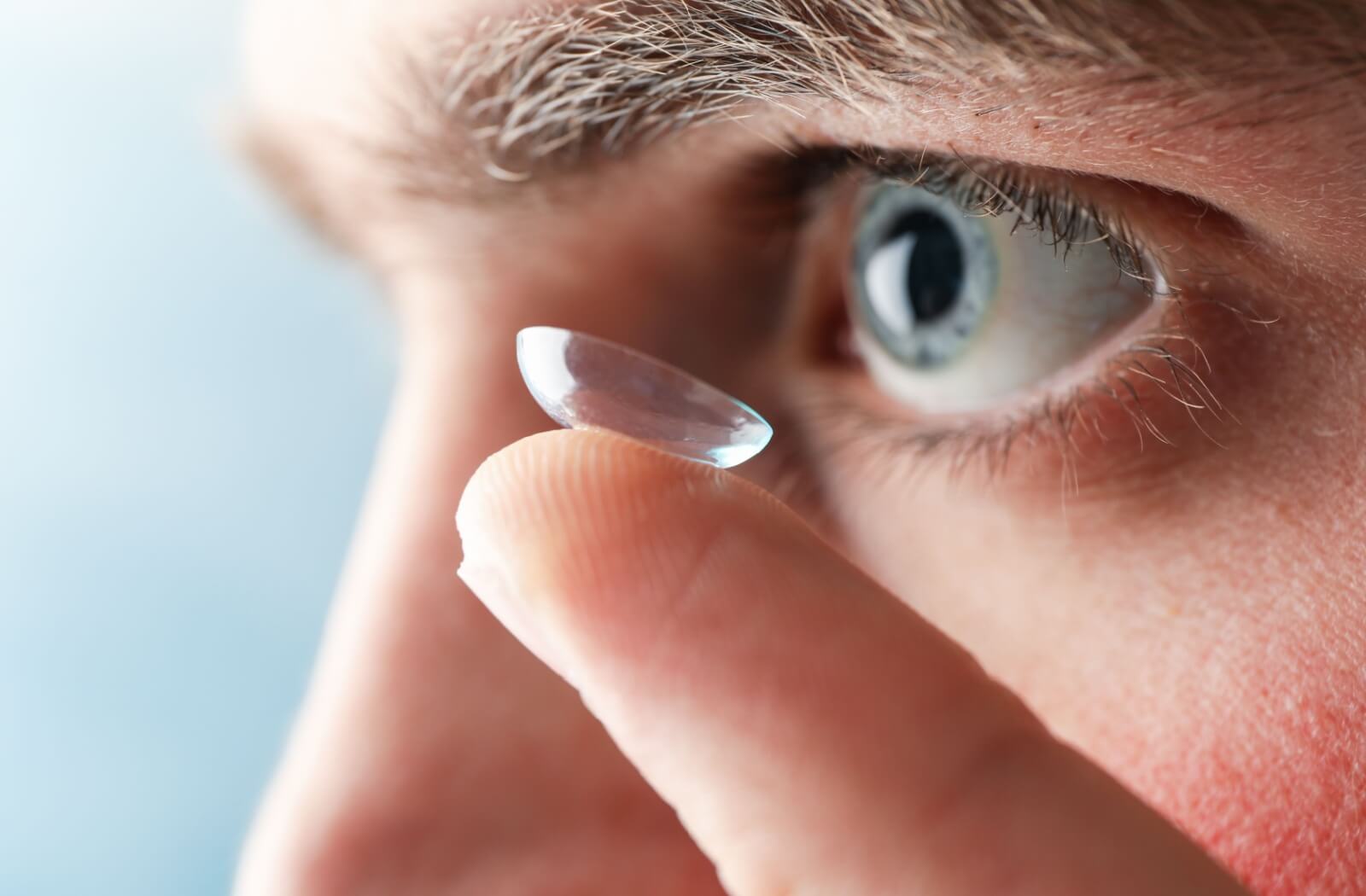 A person uses their finger to put a scleral contact lens into their eye to treat their moderate keratoconus.