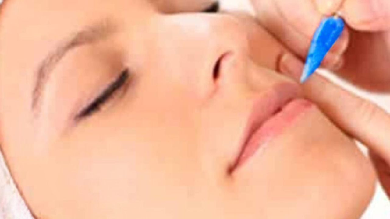 This contains an image of electrolysis service being done on the lip of a client.