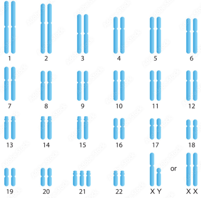 BÀI 6: ĐỘT BIẾN NHIỄM SẮC THỂ