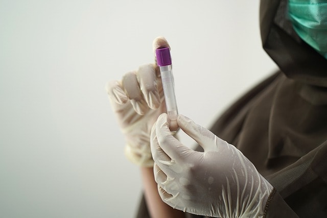 A blood test is typically only done post accident in Maricopa County for employees