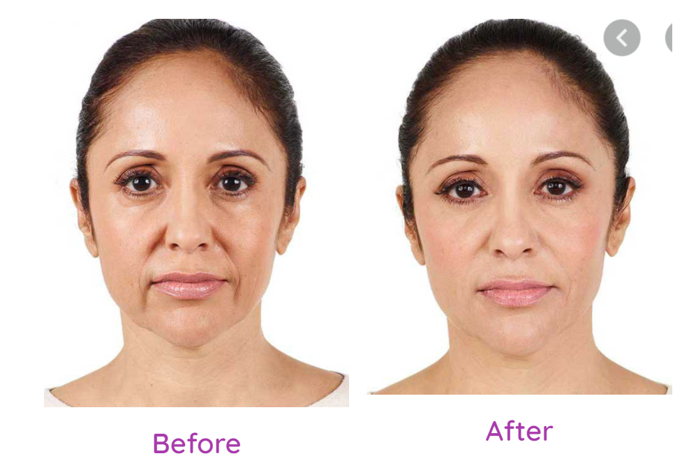 Anti - Ageing treatment in ahmedabad

