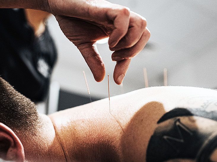 Alternative Medical Treatments for a Balanced Life