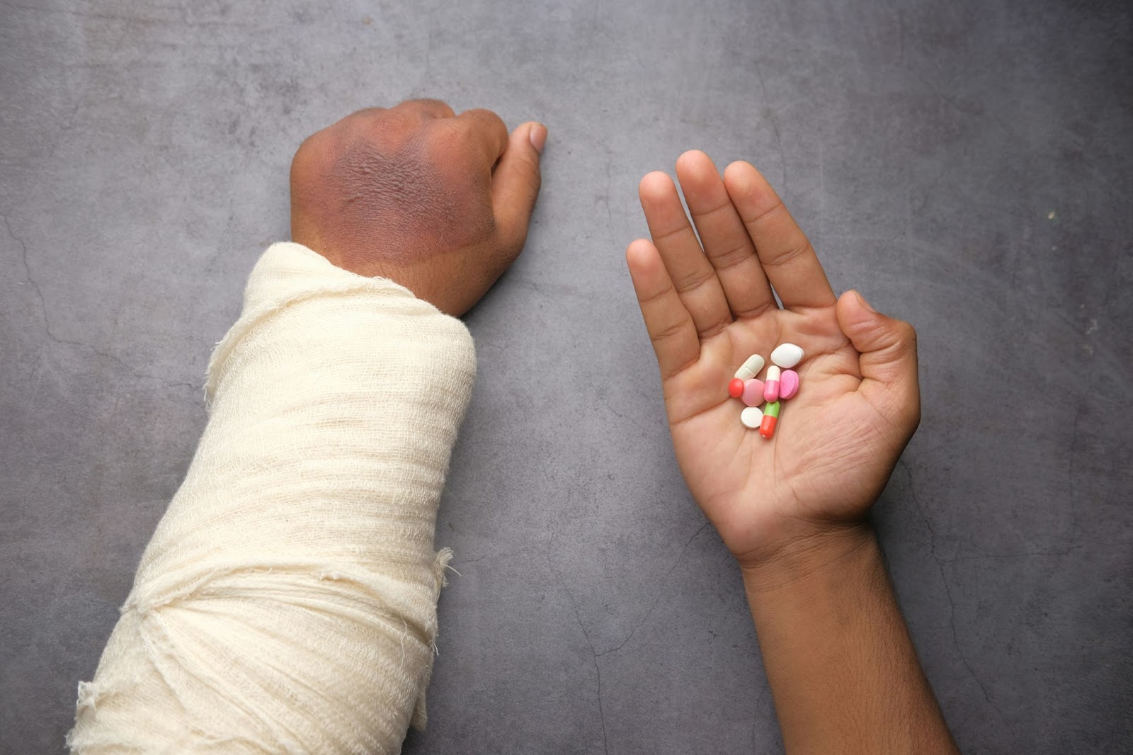 Two hands on a table: one injured and bandaged, the other holding a mix of opioids