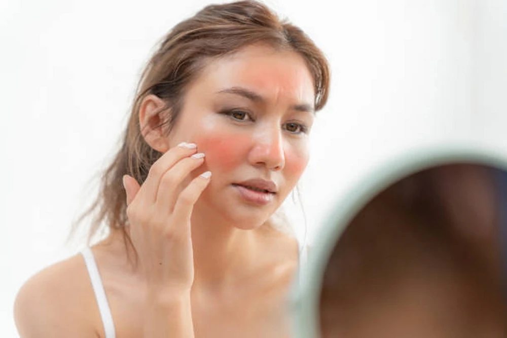 Sử dụng kem chống nắng tốt danh cho da nhạy cảm