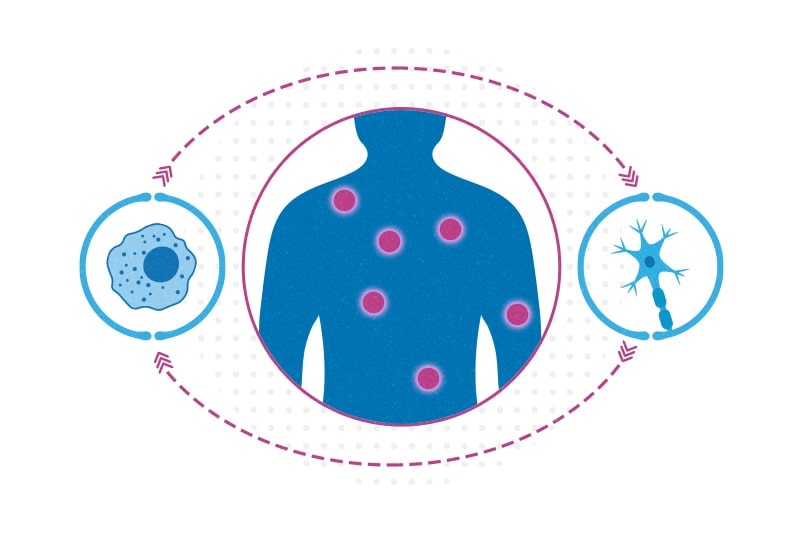 The Role of Anti-Inflammatory Properties in Pain Relief?