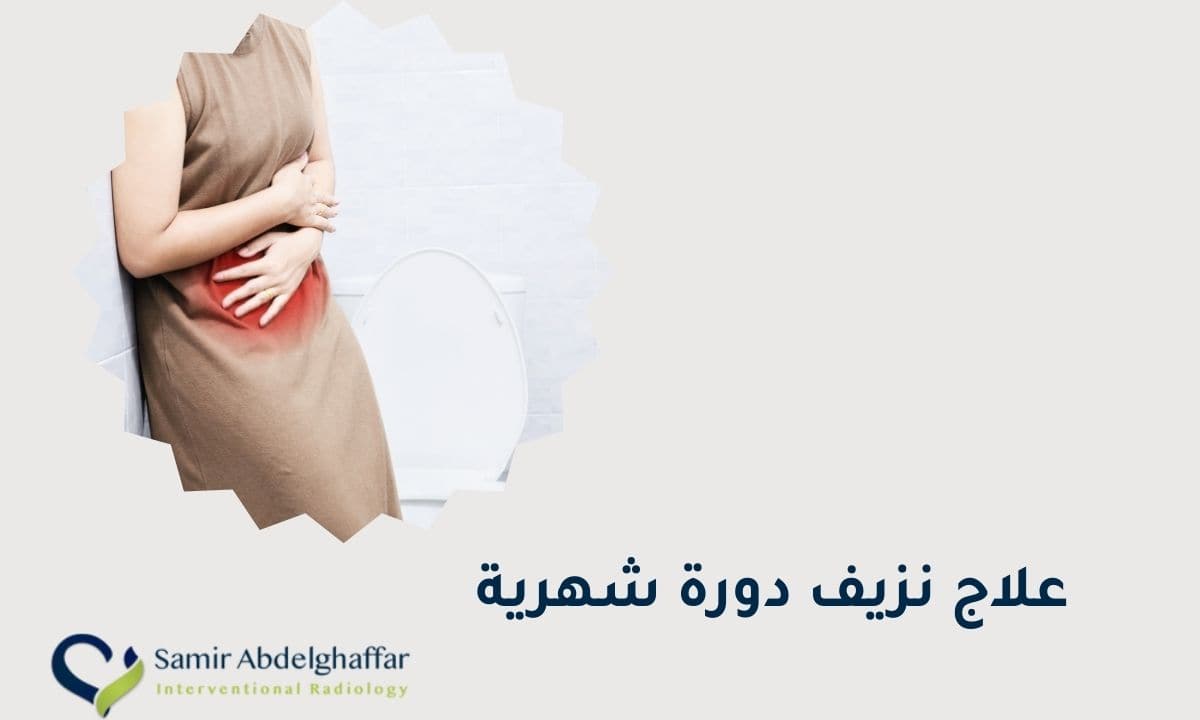 علاج نزيف الدورة الشهرية
