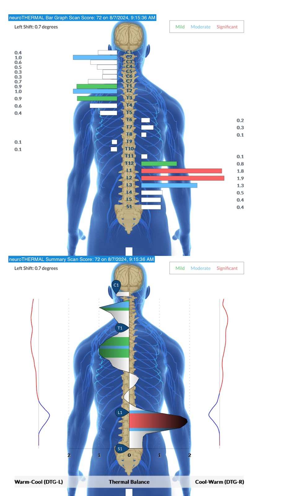 A Guide to Your Child’s Dysregulated Nervous System | PX Docs