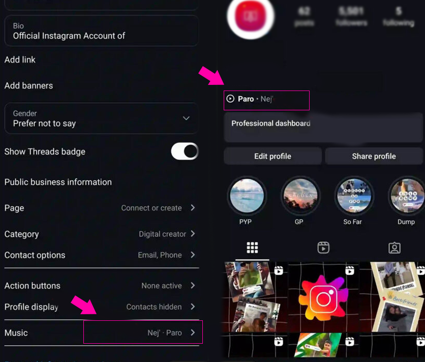 How to change your Instagram profile song?