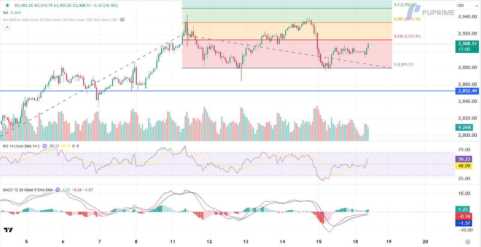 xauusd 18022025