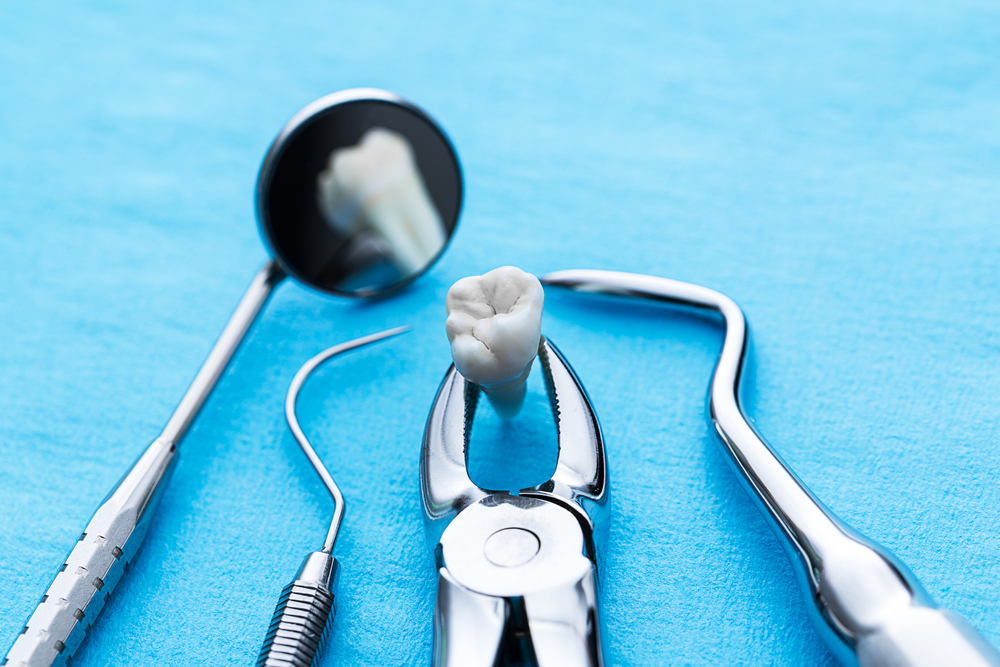 root canal or teeth extraction