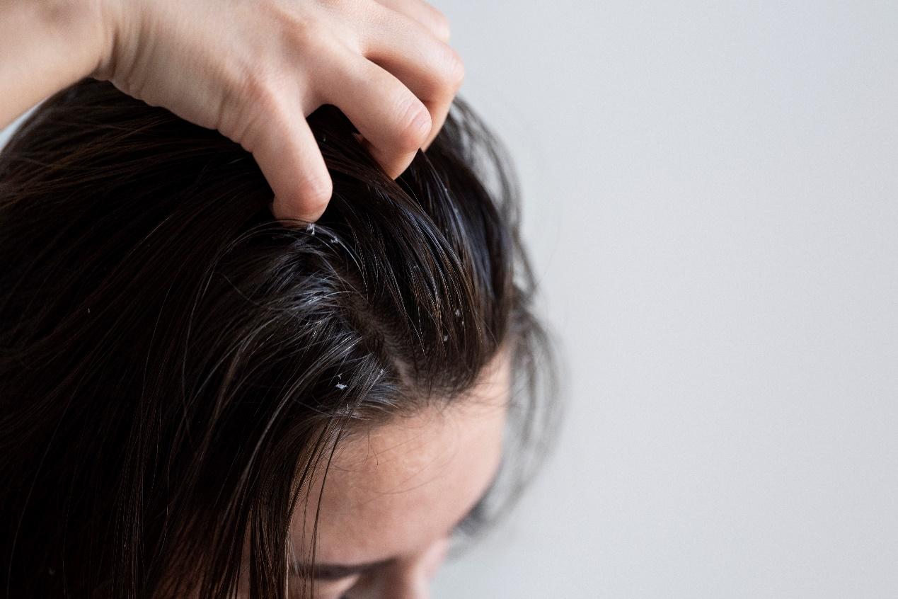 A person scratching her head

Description automatically generated