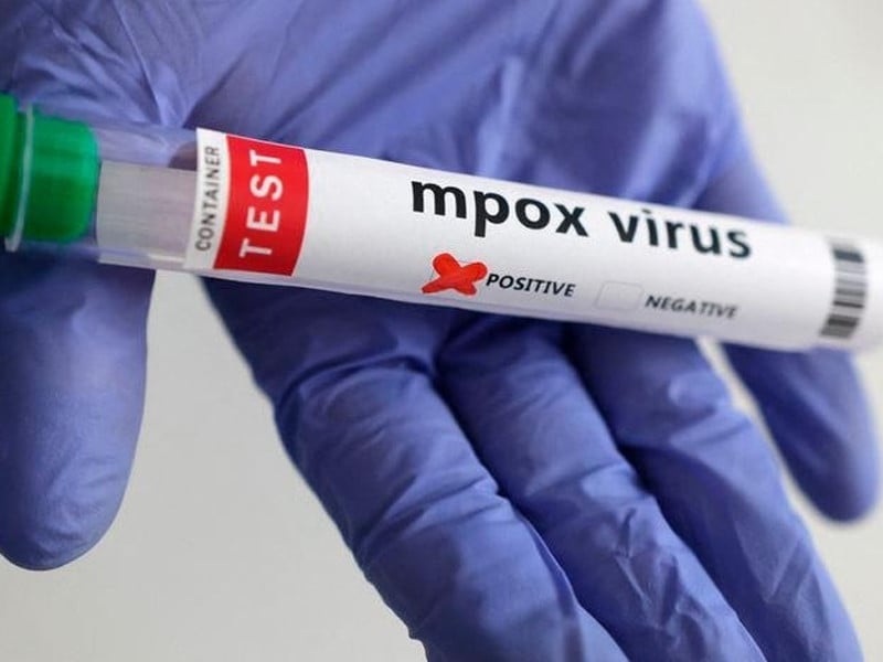 Mpox Virus testing