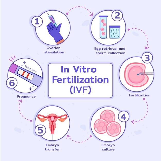 Hand drawn flat design ivf infographic