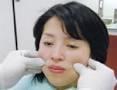 palpation du masseter 1.jpg