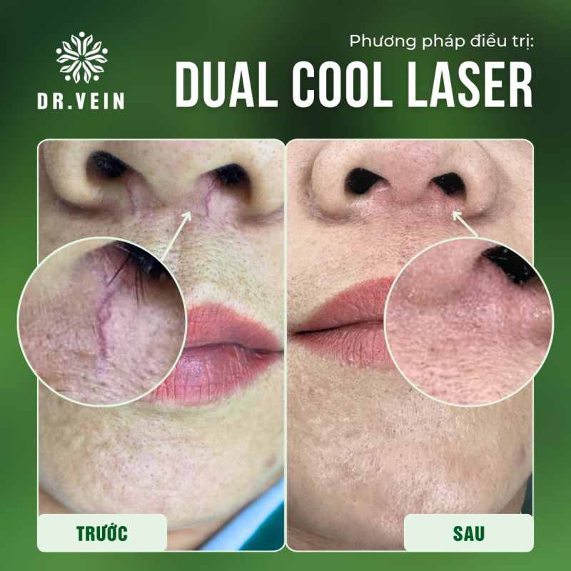 review phong kham drvein 9