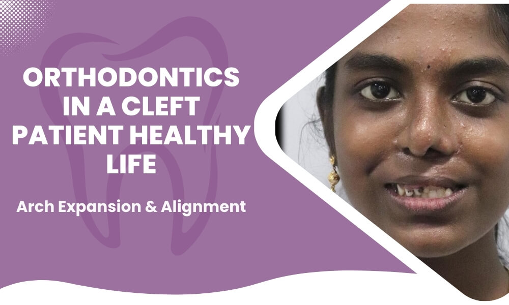 ajisha cleft orthodontics