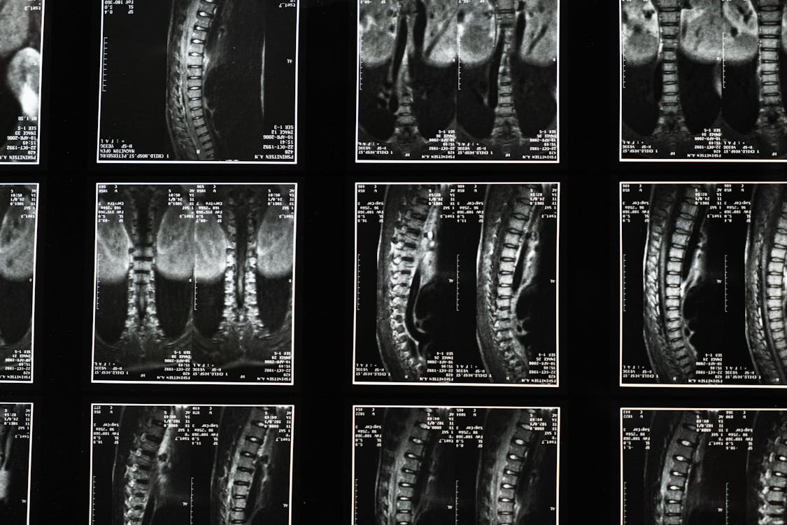 A close-up of x-ray imagesAI-generated content may be incorrect.