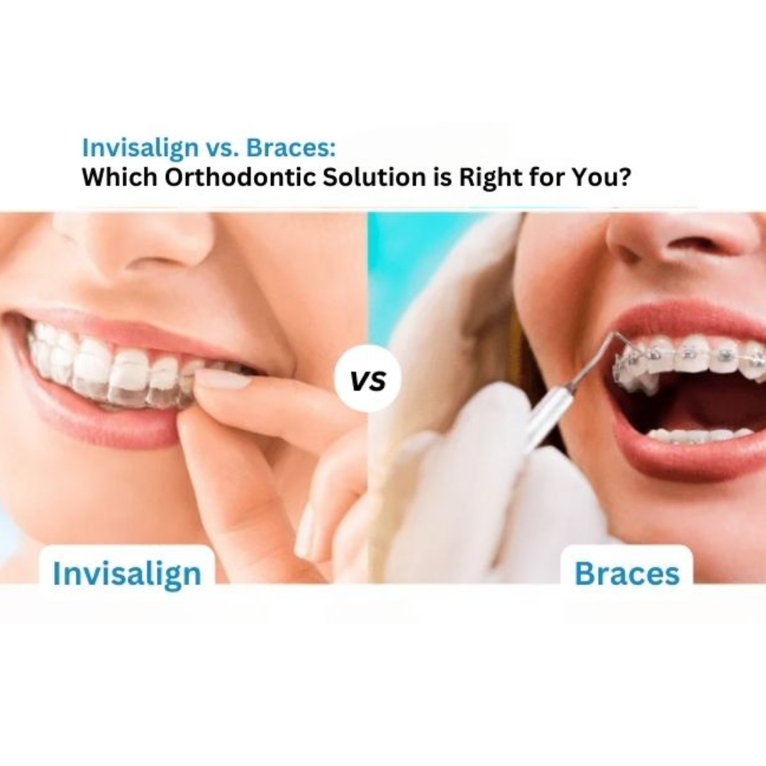 Discover the Best Orthodontists for Your Perfect Smile