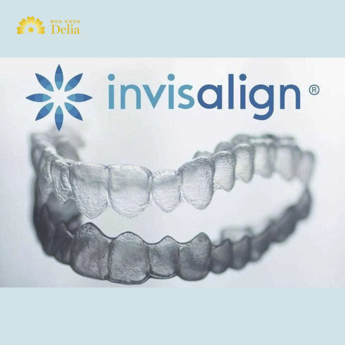 Invisalign sử dụng công nghệ quét iTero Element để thu thập hình ảnh 3D chính xác của cả hàm răng.