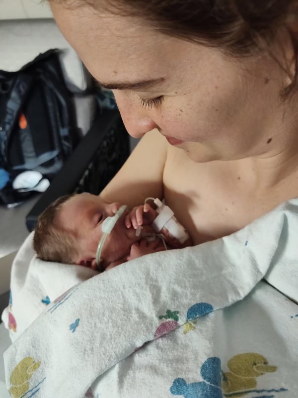 Moms holds her baby for the first time in the NICU skin-to-skin.