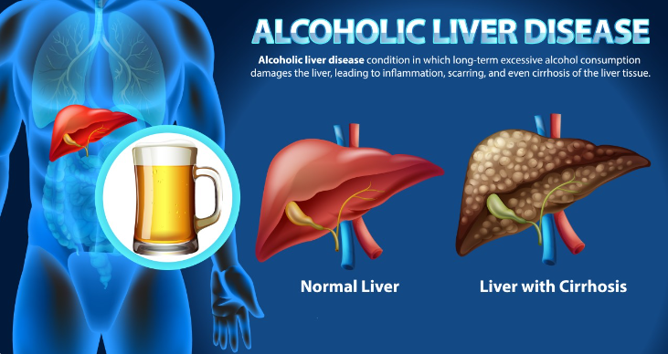 A poster of a body with liver and liver

Description automatically generated