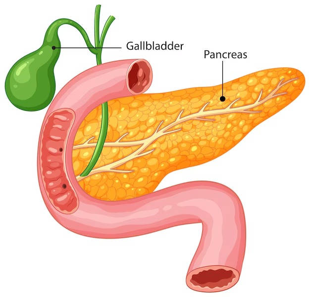 Understanding Pancreatic Conditions
