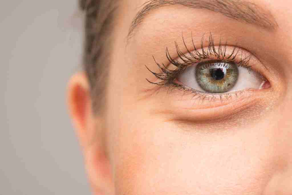swollen under eyes