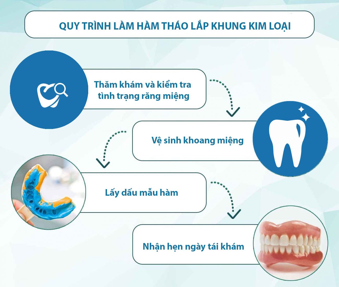 quy trình gắn hàm giả trên implant