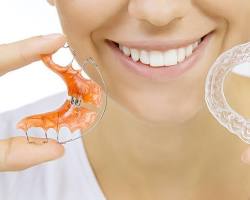 Image of Retainers