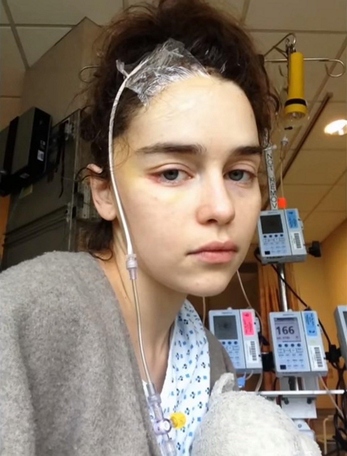 Emilia Clarke muestra las impactantes imágenes en el hospital, después del  ictus