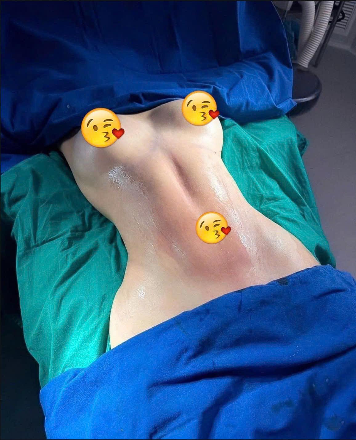 A person lying down with emojis on their backAI-generated content may be incorrect.