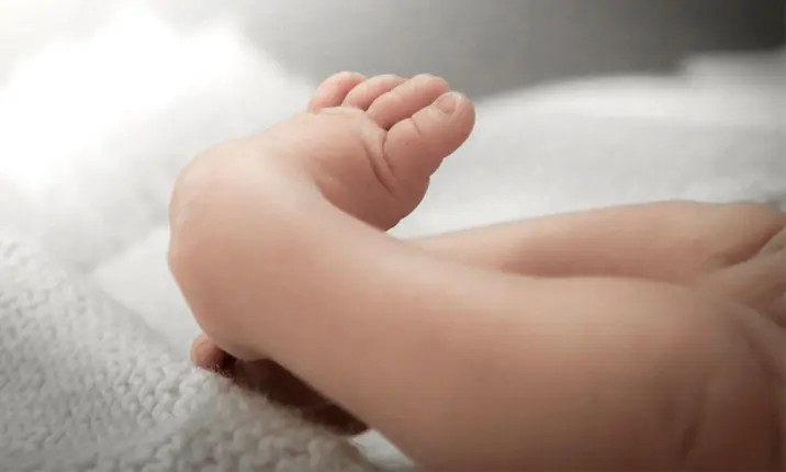 اعوجاج القدم عند الاطفال حديثي الولادة