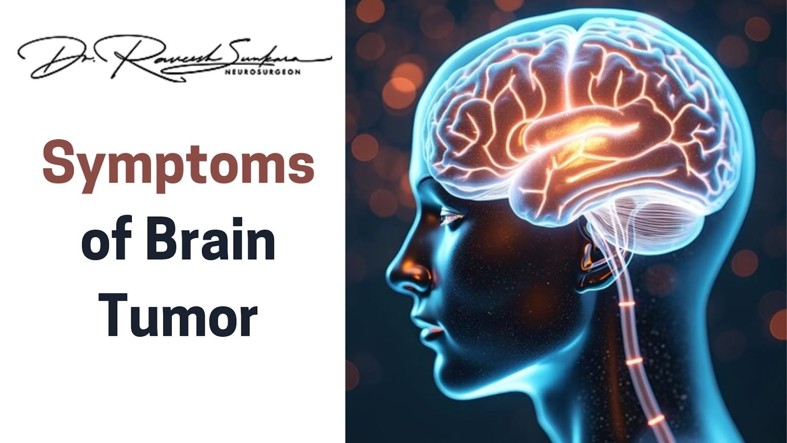 common symptoms of brain tumor