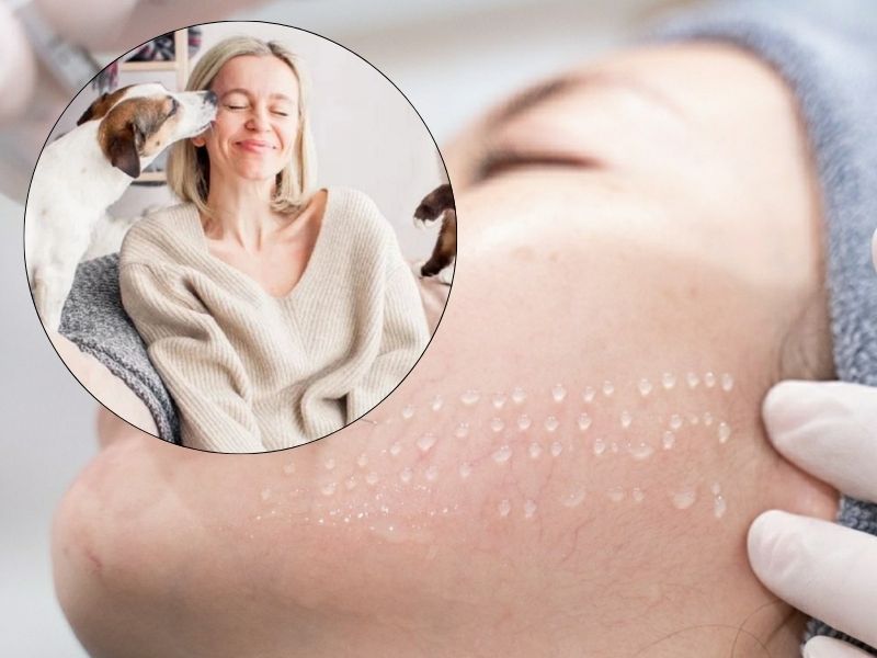 Sau khi tiêm meso có nên để thú cưng nằm gần mặt hay không? 2