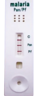 Mixed infection and Positive for plasmodium falciparum