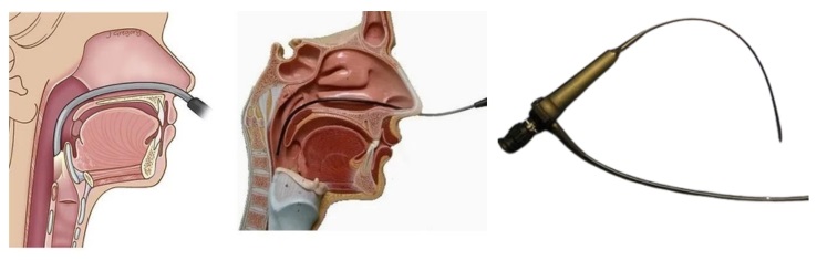 osa patients surgical treatment