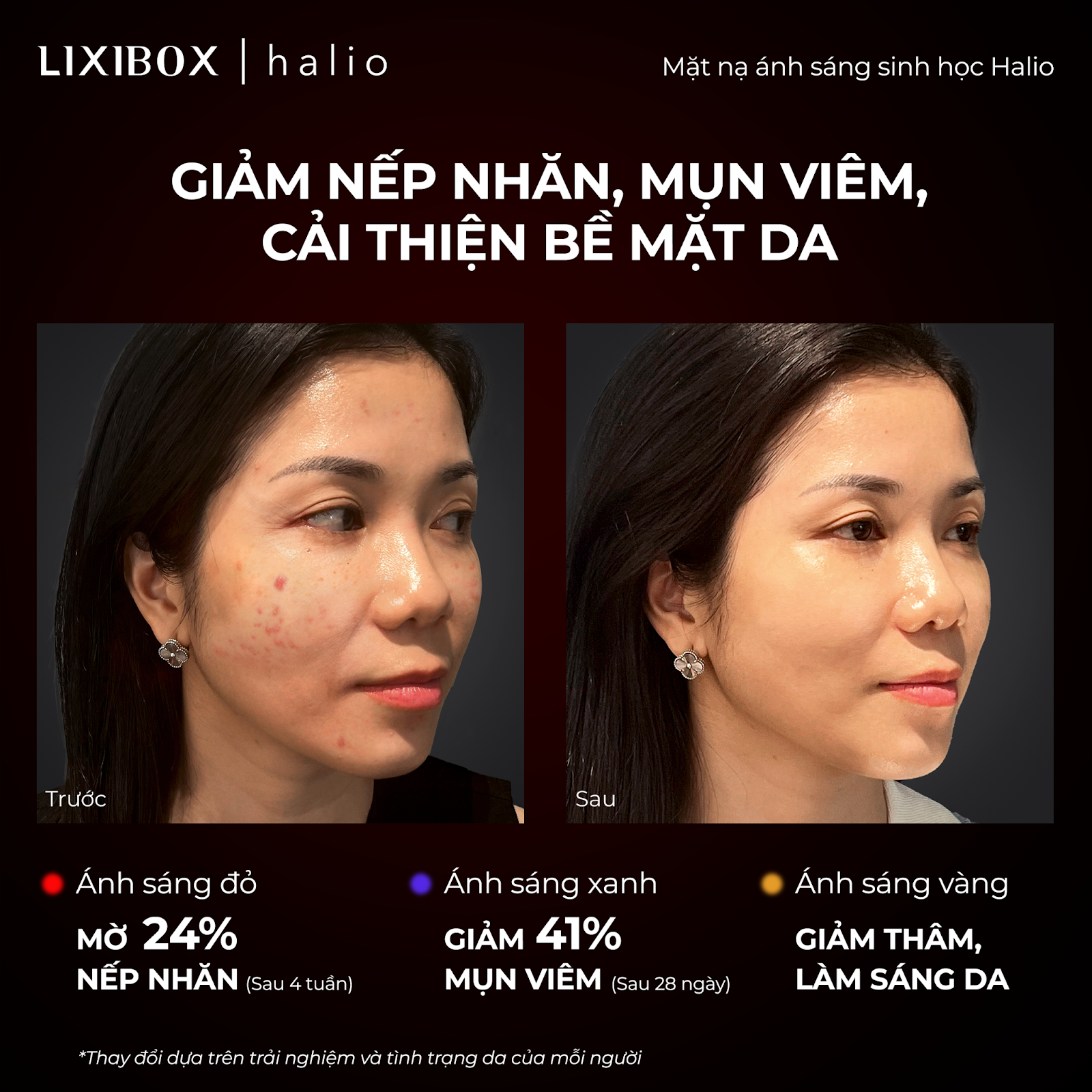 Bài viết giới thiệu về liệu pháp ánh sáng đỏ trong làm đẹp, mô tả những hiệu quả như giảm nếp nhăn 24% và giảm mụn viêm 41%. Cung cấp hướng dẫn sử dụng cũng như lợi ích chống lão hóa từ ánh sáng đỏ.