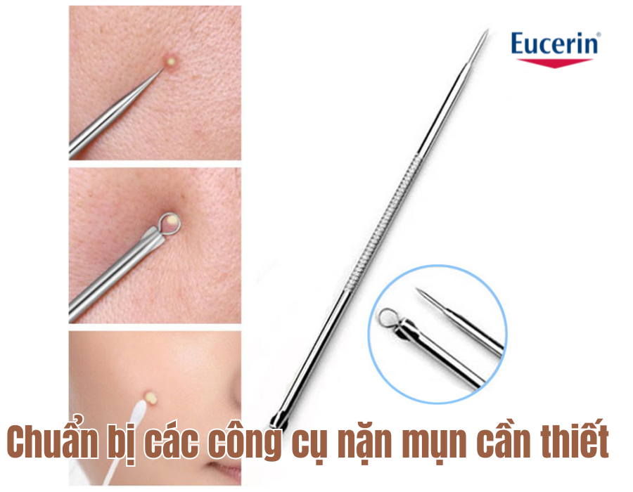 Chuẩn bị các công cụ nặn mụn cần thiết