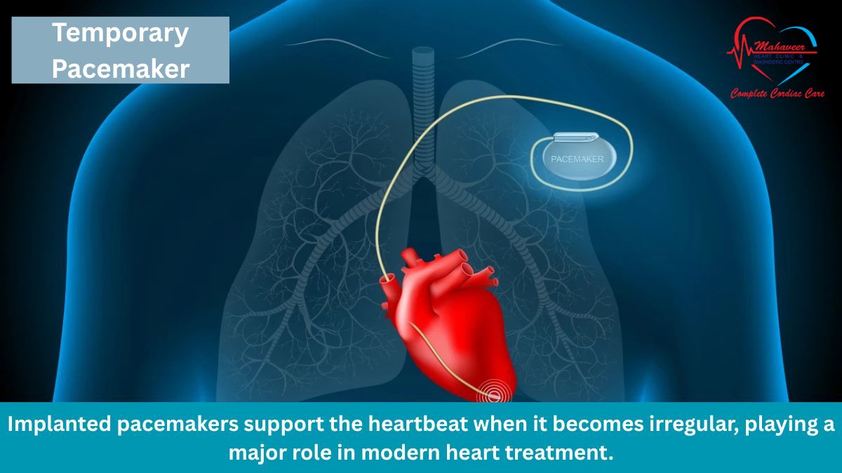 Temporary Pacemaker - Best Cardiologist, Dr Rakesh Jain
