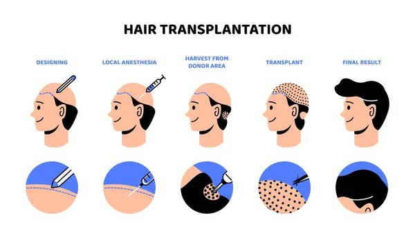 Hair Transplants
